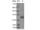 Recombinant Human TMED1 Protein (His Tag)(Active)