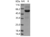 Recombinant Human TMED1 Protein (Fc Tag)(Active)