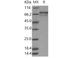 Recombinant Human PRC1 Protein (His Tag)