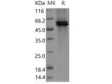 Recombinant Human AMY2A/Alpha-amylase Protein (His Tag)