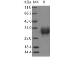 Recombinant Human LAIR1 Protein (aa 1-165, His Tag)