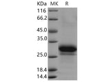 Recombinant Human PPIase/FKBP7 Protein (aa 1-218, His Tag)