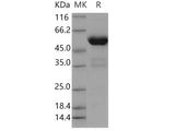 Recombinant Human PPIase/FKBP7 Protein (Fc Tag)