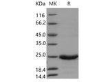 Recombinant Human GM2A Protein (Baculovirus, His Tag)