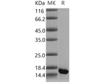 Recombinant Human GMFB Protein