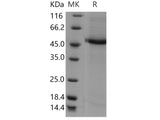 Recombinant Human CST9L/Testatin Protein (Fc Tag)