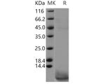 Recombinant Human CART/CARTPT Protein