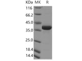 Recombinant Human CART/CARTPT Protein (Fc Tag)