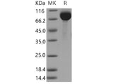 Recombinant Human AFM/Afamin Protein (His Tag)