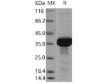 Recombinant Human FDPS Protein (His Tag)