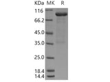 Recombinant Human LRP10 Protein (Fc Tag)