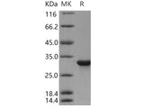 Recombinant Human CYB5R1 Protein (His Tag)