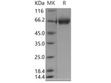 Recombinant Human TRP1/TYRP1 Protein (Human Cells, His Tag)