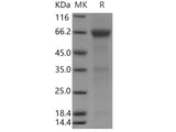 Recombinant Human ADCYAP1R1 Protein (Fc Tag)