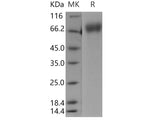 Recombinant Human IFNAR1/IFNAR Protein (His Tag)