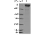 Recombinant Human IFNAR1/IFNAR Protein (Fc Tag)