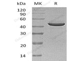 Recombinant Human SerpinB3/SCCA1 Protein (His Tag)(Active)