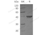 Recombinant Human UBE2I/UBC9 Protein
