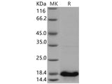 Recombinant Human UBE2D4 Protein (His Tag)