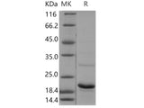 Recombinant Human UBE2G1 Protein