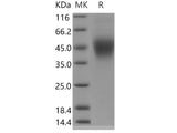 Recombinant Human FcERI/FCER1A Protein (His Tag)