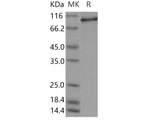 Recombinant Human STAT6 Protein (Baculovirus, His Tag)