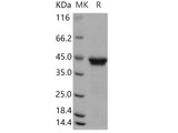 Recombinant Human RRM2B/P53R2 Protein (His Tag)