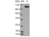 Recombinant Human SLITRK4 Protein (His Tag)