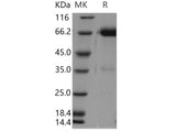 Recombinant Human Tissue Factor/CD142 Protein (Fc Tag)