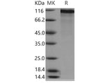 Recombinant Human NELL2 Protein (His Tag)