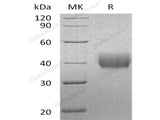 Recombinant Human Mesothelin/MSLN Protein (His Tag)