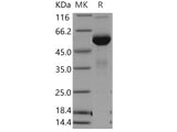 Recombinant Human Mesothelin/MSLN Protein (Fc Tag)