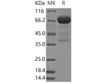 Recombinant Human Mesothelin/MSLN Protein (aa 296-580, Fc Tag)