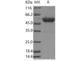 Recombinant Human TNFSF4/OX40L Protein (Fc Tag)