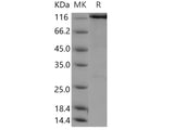 Recombinant Human WWP2 Protein (His & GST Tag)