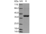 Recombinant Human CANT1 Protein (His Tag)