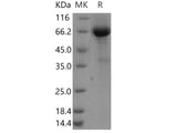 Recombinant Human CANT1 Protein (Fc Tag)