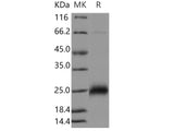 Recombinant Human CGB7 Protein (His Tag)