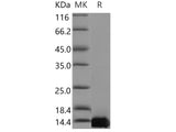 Recombinant Human TFAP2C/AP2-GAMMA Protein (His Tag)