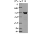 Recombinant Human PRL-2/PTP4A2 Protein (GST Tag)