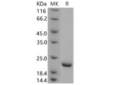 Recombinant Human SUMO1 Protein (His Tag)(Active)