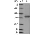 Recombinant Human IGSF11/BTIGSF Protein (His Tag)