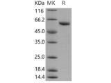 Recombinant Human TXNRD1/TRXR1 Protein (aa 161-647, His Tag)