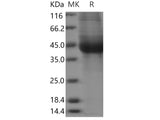 Recombinant Human IL17BR/IL17RB Protein (His Tag)(Active)