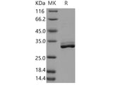 Recombinant Human MYOC/Myocilin Protein (His Tag)