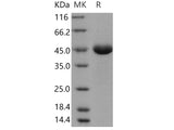 Recombinant Human PGA4/Pepsinogen A Protein (His Tag)(Active)