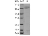 Recombinant Human PGA4/Pepsinogen A Protein (Fc Tag)(Active)