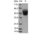 Recombinant Human TSPAN1 Protein (aa 110-211, Fc Tag)