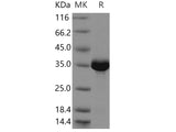 Recombinant Human NUDT5/ADP-sugar Pyrophosphatase Protein (His Tag)