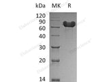 Recombinant Human GOLPH2/GOLM1 Protein (aa 40-401, His Tag)
